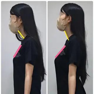 姿勢・骨盤/小顔矯正 痩身ダイエット 横田のエステ・リラクイメージ