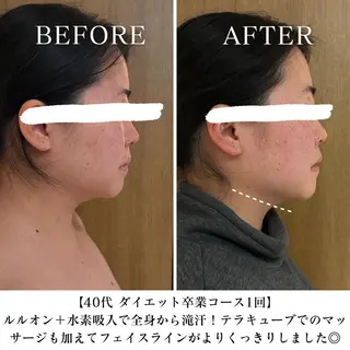 【三軒茶屋/下馬】 本格痩身・よもぎ蒸しのエステ・リラクイメージ