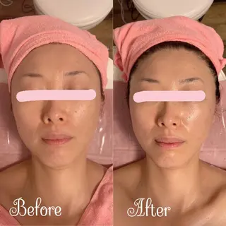 透明感の肌Lino malieのエステ・リラクイメージ