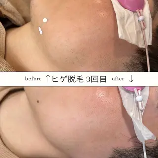 メンズ SKIN GYM所属・SKIN GYM メンズ専門脱毛サロンのエステ・リラクイメージ