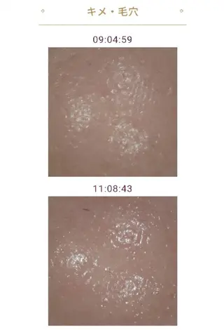 メナードフェイシャルサロンライズミュー所属・鈴木 由美のエステ・リラクイメージ