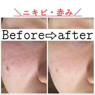 都度払い肌改善専門店 店長二上文香のエステ・リラクイメージ