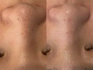 mili mili beauty salon所属・mili mili 岡本のエステ・リラクイメージ