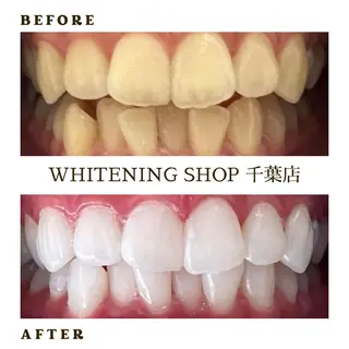 メンズ ホワイトニング ショップ千葉店のその他イメージ