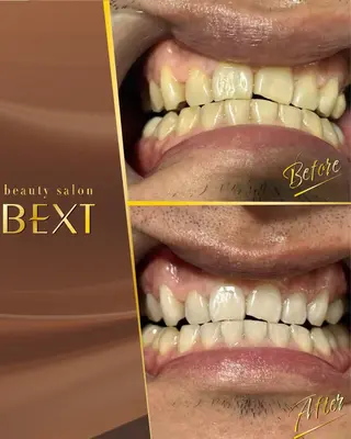 メンズ ビューティーサロンベクスト beautysalonBEXT所属・ビューティーサロン ベクスト名古屋のエステ・リラクイメージ