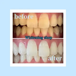 ホワイトニングショップ光明池店所属・ホワイトニング ショップ光明池店のエステ・リラクイメージ