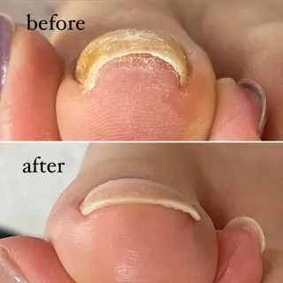 ネイル nima nail所属・Ueda Riraのネイルデザイン