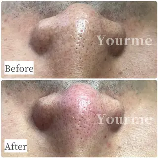 毛穴肌質ケアサロン Yourmeユアミーのエステ・リラクイメージ