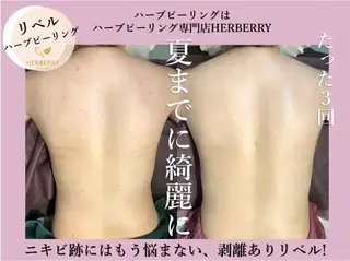 ハーブピーリング専門店HERBERRY難波心斎橋店所属・ハーブピーリング専門 HERBERRY冨永のエステ・リラクイメージ