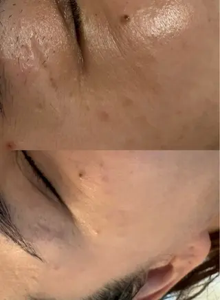 トータルビューティー サロン・Ｎの眉毛・アイブロウイメージ