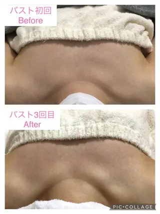 子宮矯正/腸揉み/ シュガーリング脱毛のエステ・リラクイメージ