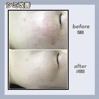 🌿小顔・痩身・脱毛 レイビス川崎店🌿のエステ・リラクイメージ