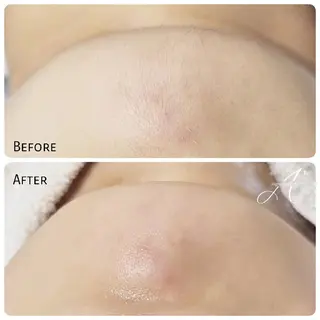 A*《エースター》 シュガーリング🍋のエステ・リラクイメージ