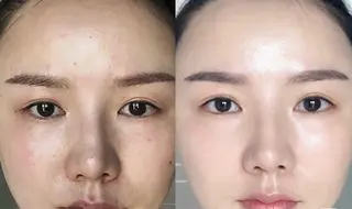 ネイル aliaハイフ&水光ジェットサロン所属・aliaハーブ水光店 エステティシャン募集のエステ・リラクイメージ