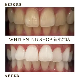 メンズ ホワイトニング ショップ新小岩店のその他イメージ