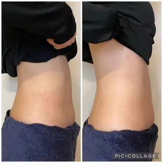 腸セラピーサロン ナチュモアのエステ・リラクイメージ