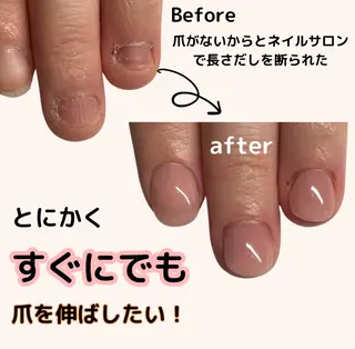 ネイル 深爪矯正専門店ネイルサロンKUU所属・深爪矯正専門店 ネイルサロンKUUのネイルデザイン