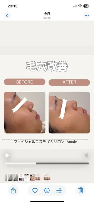 CSサロン Amule所属・🦋肌質改善サロン. anna🦋のエステ・リラクイメージ