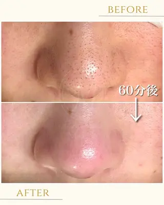 salon de beauté More所属・More 大阪福島区 毛穴・肌質改善のエステ・リラクイメージ