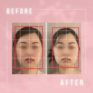 小顔・肌悩み専門店 ボーテドリッシュのエステ・リラクイメージ