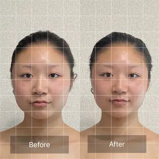 小顔集中型エステ 堺／大美野のエステ・リラクイメージ