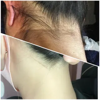 うなじ/もみあげ脱毛 ヴィシェーン佐藤のその他イメージ