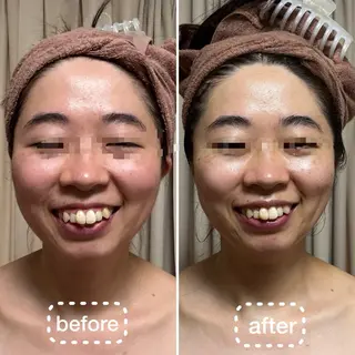 透明感の肌Lino malieのエステ・リラクイメージ