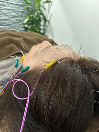 美容鍼灸整体サロンBeauJu所属・小顔矯/美容鍼/鍼灸 BeauJuのその他イメージ