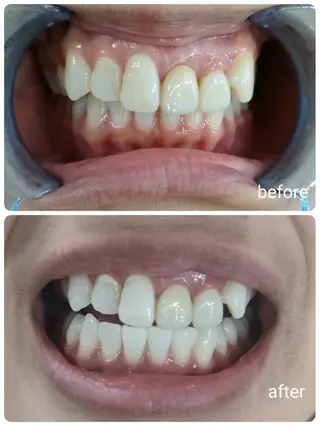 セルフホワイトニングサロン　エクシアホワイト西尾店所属・エクシアホワイト西尾 堀内恵のその他イメージ