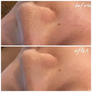 メンズ メナード岐阜市茜部 杉浦のエステ・リラクイメージ