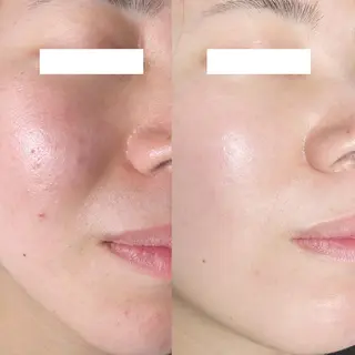 Monreve所属・美人スイッチdiet スーパージェクションのその他イメージ