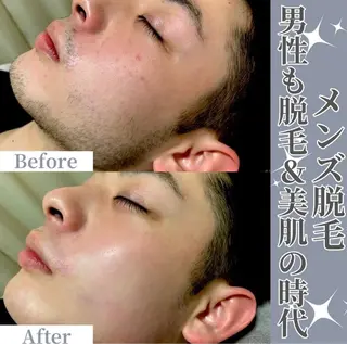 脱毛サロンALGO所属・美肌脱毛/ワックス ALGO高槻店のエステ・リラクイメージ