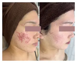 プライベートサロン Grast🪴アイカのエステ・リラクイメージ