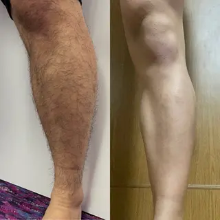 メンズ メンズオーシャンブルー福岡店所属・柿添 希実のエステ・リラクイメージ