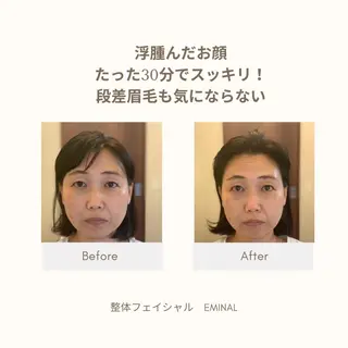 整体フェイシャル EMINALのエステ・リラクイメージ