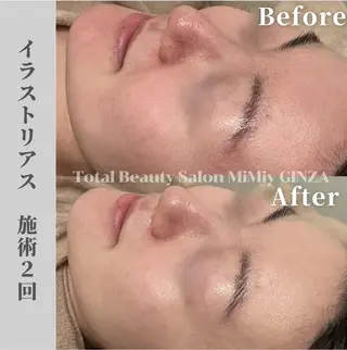 MiMiy 銀座店のエステ・リラクイメージ