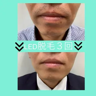 メンズ GrandAzure 大人の肌改善のエステ・リラクイメージ