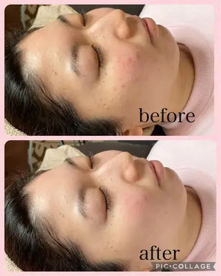 NATURA所属・シェービングサロン NATURAのエステ・リラクイメージ