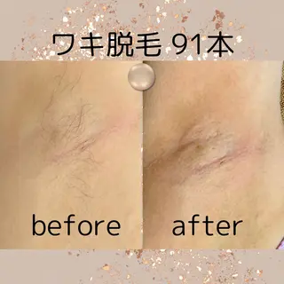 中庄駅前エステ BRILLAR小豆のヘアスタイル