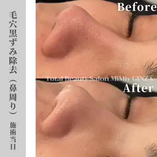 MiMiy 銀座店のエステ・リラクイメージ