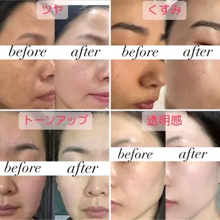 ショート aliaハイフ&水光ジェットサロン所属・aliaハーブ水光店 エステティシャン募集のエステ・リラクイメージ