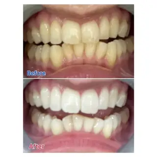 M渋谷店所属・M渋谷 ホワイトニングのエステ・リラクイメージ