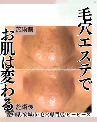 B  peace beauty salon所属・B peace. はるかのマツエク・マツパデザイン