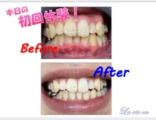 セルフホワイトニングサロン　ラヴィアン所属・ホワイトニングサロン La vie enのその他イメージ