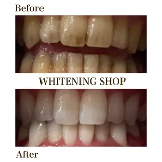 メンズ ホワイトニング ショップ川越店のエステ・リラクイメージ