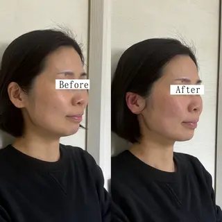 Private salon La.所属・Stellum 小顔矯正&ヘッドスパのエステ・リラクイメージ