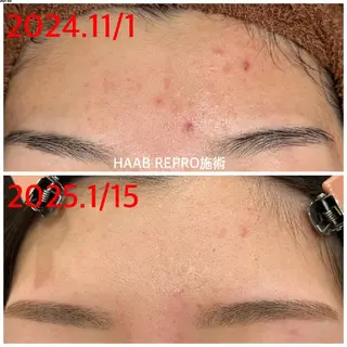 アイブロウ/眉毛🌈 JEC認定✨小栗幸恵のエステ・リラクイメージ