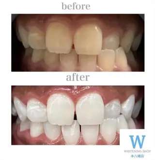 ホワイトニング ショップ本八幡店のエステ・リラクイメージ