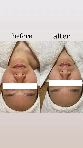 肌質改善専門店 メナード上里のエステ・リラクイメージ