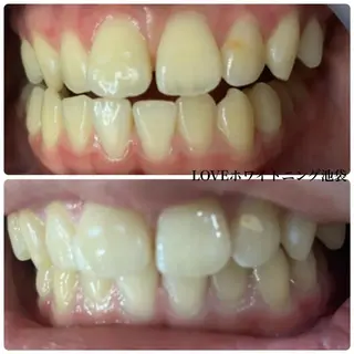 メンズ LOVEホワイト ニング恵比寿店のその他イメージ